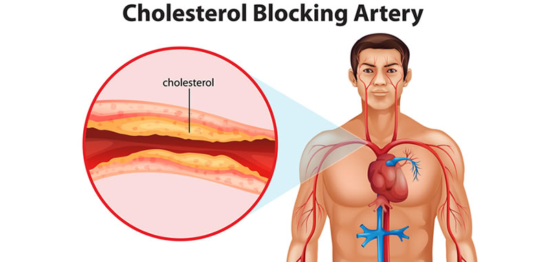 Què és el colesterol?