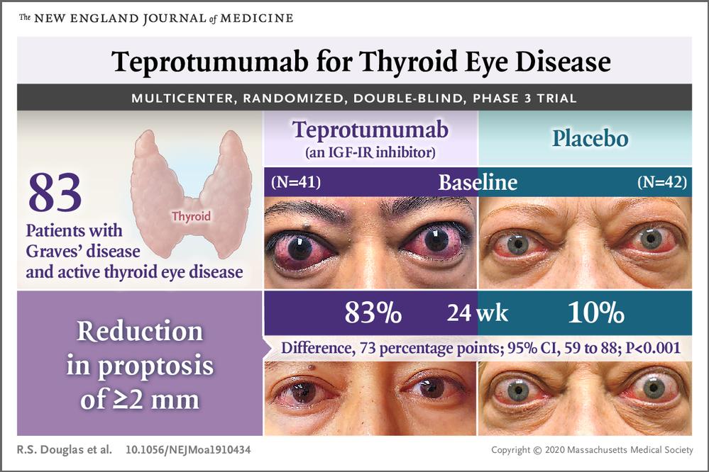 Teprotumumab: la primera medicació específicament aprovada per tractar la malaltia ocular tiroïdal activa.